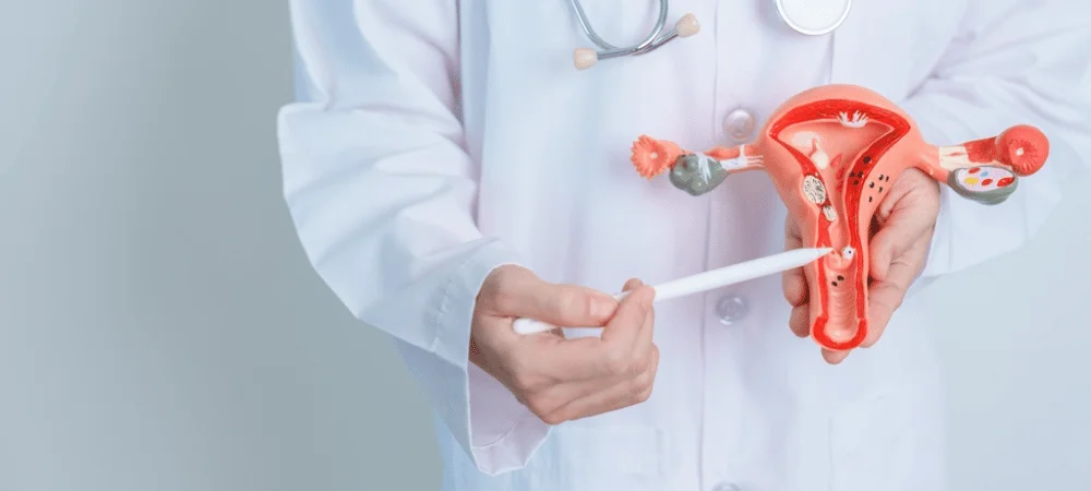 Doctor showing female reproductive system model for treatment by best ovary cancer surgeon