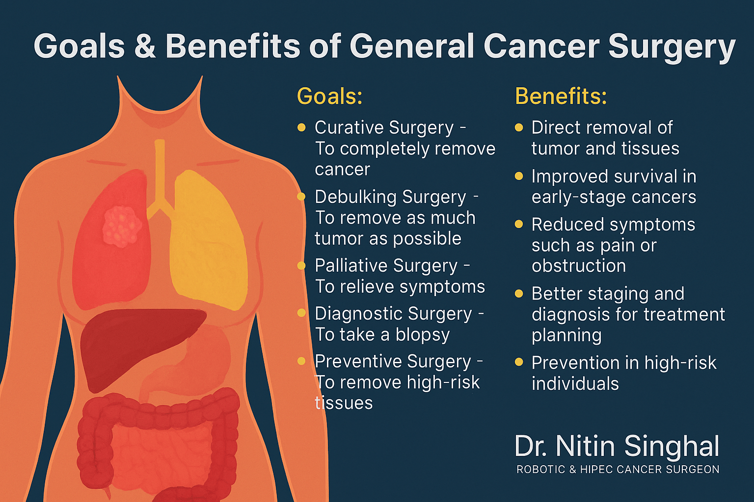Goals and Benefits of General Cancer Surgery infographic with organ illustration