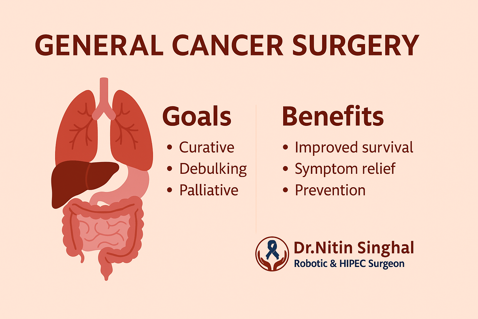 Goals and Benefits of General Cancer Surgery infographic with organ illustration